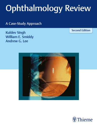 ophthalmology review a case study approach pdf